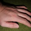 Dicker Finger